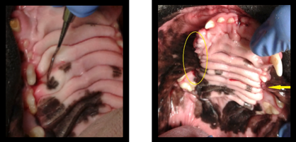 This view of Jaxon’s mouth shows, on the left side of the photograph, multiple extraction sites. (The canine tooth and a premolar were removed). The arrow on the right indicates the extraction of the affected tooth shown in the photo just above this one. 